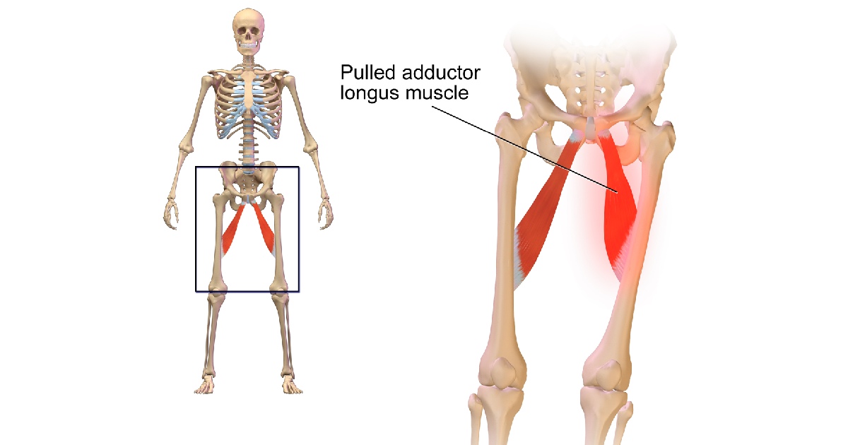 Adductor Longus